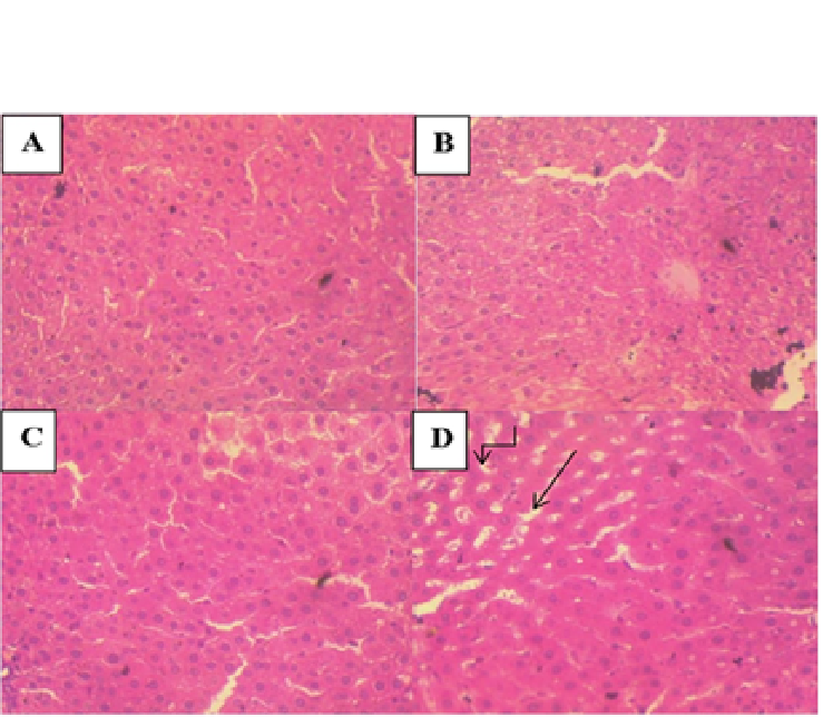 Histopathological examination of the liver in the sub-acute toxicity studies of CAPE