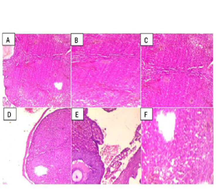 Prophylactic effects of Citrus aurantifolia peels on the histological examination in Doxorubicin-induced ovarian toxicity in rats